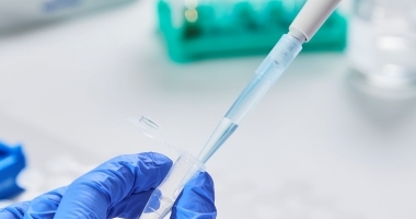 Metabolomic biomarkers of multiple myeloma: A systematic review
