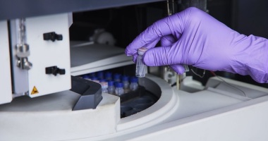A novel preliminary metabolomic panel for IHD diagnostics and pathogenesis