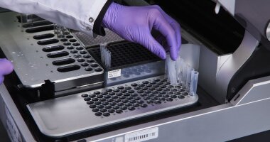 Metabolomics of head and neck cancer in biofluids: an integrative systematic review