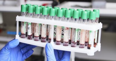 LC-MS/MS determination of GTS-201, a dipeptide mimetic of the brain-derived neurotrophic factor, and neurotransmitter metabolites with application to a pharmacokinetic study in rats