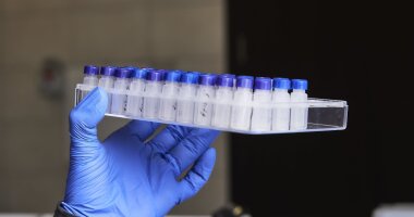 Determination of the immunostimulatory drug-glucosoaminyl-muramyl-dipeptide-in human plasma using HPLC-MS/MS and its application to a pharmacokinetic study